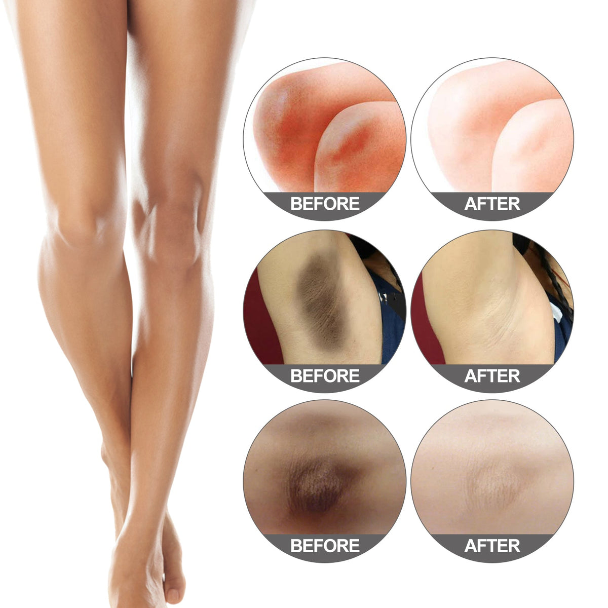 Beauty Care, Moisturizing And Brightening For Elbow And Knee Joints, Black Exfoliating, Nourishing And Whitening
